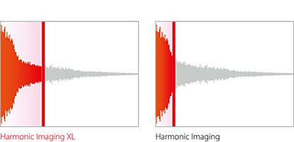 picture illustrating the additional sample time harmonic imaging xl takes to capture a sound sample